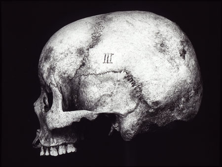 Excavated Dinka skull