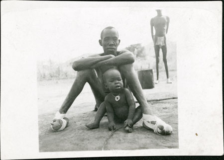 Portrait of a man and child with leprosy 