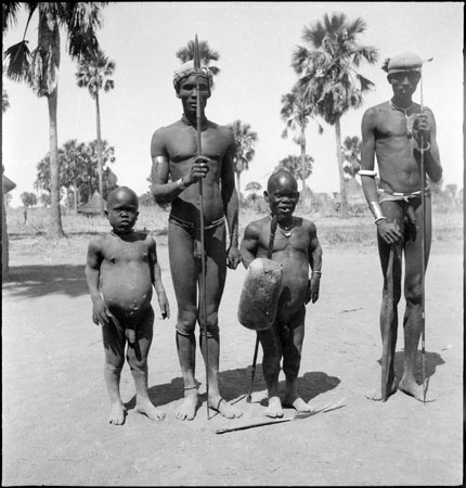 Dinka men with dwarfism